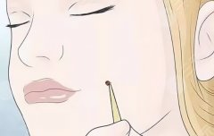 普通痣和黑色素痣区别