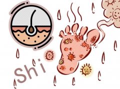 南京看脚癣好的医院