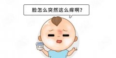 得了皮炎,哪些食物要“拉黑”?